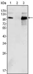 Anti-Androgen Receptor antibody [2H8] used in Western Blot (WB). GTX83309