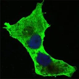 Anti-Daxx antibody [7A11] used in Immunocytochemistry/ Immunofluorescence (ICC/IF). GTX83312