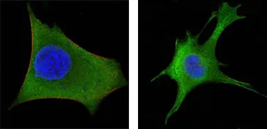 Anti-Wnt1 antibody [10C8] used in Immunocytochemistry/ Immunofluorescence (ICC/IF). GTX83320