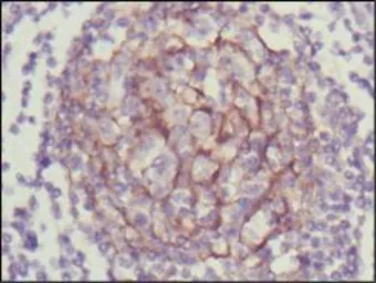Anti-TrkC antibody [7H6] used in IHC (Paraffin sections) (IHC-P). GTX83321
