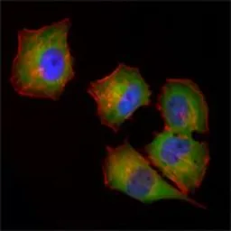Anti-nm23-H1 antibody [4B2] used in Immunocytochemistry/ Immunofluorescence (ICC/IF). GTX83325