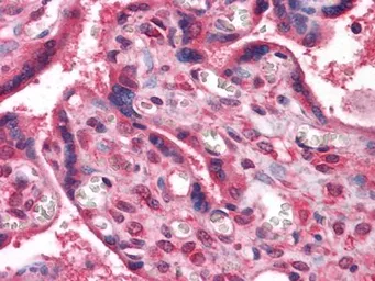 Anti-nm23-H1 antibody [4B2] used in IHC (Paraffin sections) (IHC-P). GTX83325