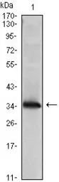 Anti-nm23-H1 antibody [4B2] used in Western Blot (WB). GTX83325