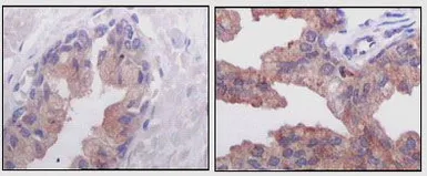 Anti-AMACR antibody [2A10F3] used in IHC (Paraffin sections) (IHC-P). GTX83326