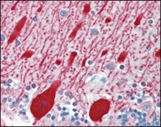 Anti-AMACR antibody [2A10F3] used in IHC (Paraffin sections) (IHC-P). GTX83326