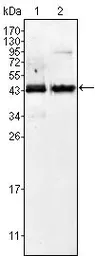 Anti-AMACR antibody [2A10F3] used in Western Blot (WB). GTX83326