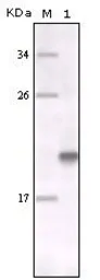 Anti-MERTK antibody [7E5G1] used in Western Blot (WB). GTX83328