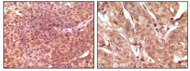 Anti-SRA antibody [7H1G1] used in IHC (Paraffin sections) (IHC-P). GTX83331