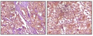 Anti-EphB4 antibody [5B8F7] used in IHC (Paraffin sections) (IHC-P). GTX83333