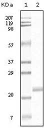 Anti-EphB4 antibody [5B8F7] used in Western Blot (WB). GTX83333