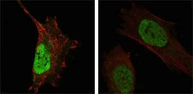 Anti-MDMX antibody [2D10F4] used in Immunocytochemistry/ Immunofluorescence (ICC/IF). GTX83335