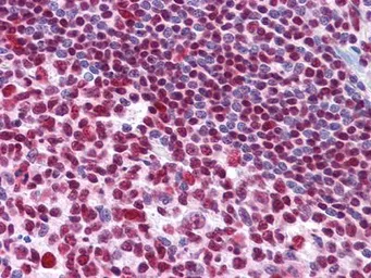 Anti-MDMX antibody [2D10F4] used in IHC (Paraffin sections) (IHC-P). GTX83335