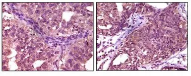 Anti-EphA1 antibody [5D2] used in IHC (Paraffin sections) (IHC-P). GTX83346
