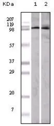 Anti-EphA1 antibody [5D2] used in Western Blot (WB). GTX83346
