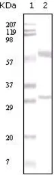 Anti-Estrogen Receptor alpha antibody [2B7] used in Western Blot (WB). GTX83349