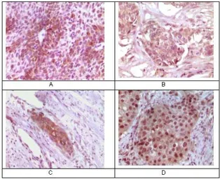 Anti-Rab25 antibody [3F12F3] used in IHC (Paraffin sections) (IHC-P). GTX83350