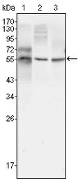 Anti-beta Tubulin 3/ Tuj1 antibody [2E9] used in Western Blot (WB). GTX83356