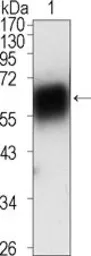 Anti-ROR1 antibody [2H6] used in Western Blot (WB). GTX83359
