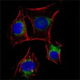 Anti-p75 NGF Receptor / CD271 antibody [2F1C2] used in Immunocytochemistry/ Immunofluorescence (ICC/IF). GTX83360