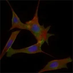 Anti-FABP2 antibody [9A9B7B3] used in Immunocytochemistry/ Immunofluorescence (ICC/IF). GTX83361