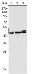 Anti-Cytokeratin 17 antibody [3B12] used in Western Blot (WB). GTX83366