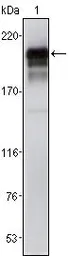 Anti-PDGF Receptor beta antibody [1A2] used in Western Blot (WB). GTX83371