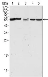 Anti-PAK2 antibody [3B5] used in Western Blot (WB). GTX83373