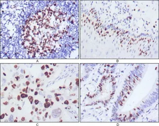 Anti-Ki67 antibody [4A1] used in IHC (Paraffin sections) (IHC-P). GTX83375