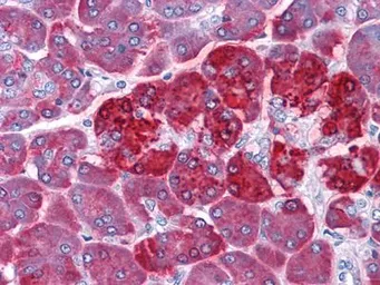 Anti-REG1A antibody [1A4] used in IHC (Paraffin sections) (IHC-P). GTX83376