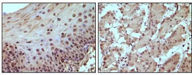 Anti-Rb antibody [7E4B8] used in IHC (Paraffin sections) (IHC-P). GTX83384