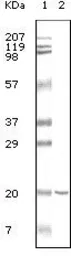 Anti-CD19 antibody [2E2B6B10] used in Western Blot (WB). GTX83387