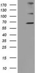 Anti-ZIM2 antibody [7G1] used in Western Blot (WB). GTX83402