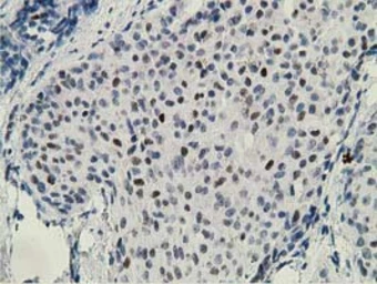 Anti-ZIM2 antibody [5E12] used in IHC (Paraffin sections) (IHC-P). GTX83403