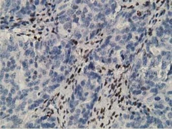 Anti-ZIM2 antibody [5E12] used in IHC (Paraffin sections) (IHC-P). GTX83403
