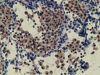 Anti-ZIM2 antibody [5E12] used in IHC (Paraffin sections) (IHC-P). GTX83403