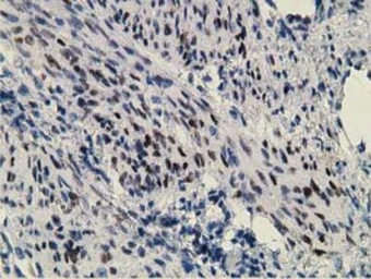 Anti-ZIM2 antibody [5E12] used in IHC (Paraffin sections) (IHC-P). GTX83403