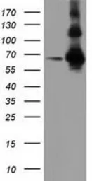 Anti-ZIM2 antibody [5E12] used in Western Blot (WB). GTX83403