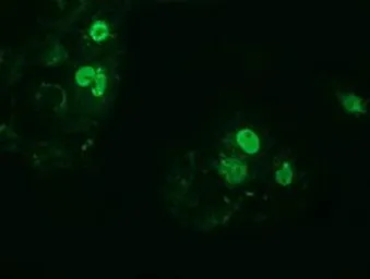 Anti-ZIM2 antibody [5E12] used in Immunocytochemistry/ Immunofluorescence (ICC/IF). GTX83403