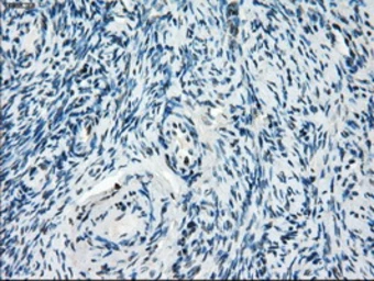 Anti-Tristetraprolin antibody [8B5] used in IHC (Paraffin sections) (IHC-P). GTX83404