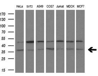 Anti-Tristetraprolin antibody [8B5] used in Western Blot (WB). GTX83404
