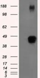 Anti-Tristetraprolin antibody [8B5] used in Western Blot (WB). GTX83404