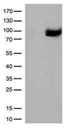 Anti-XRCC1 antibody [2D8] used in Western Blot (WB). GTX83411