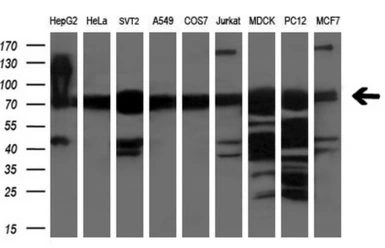 Anti-XPNPEP1 antibody [1E3] used in Western Blot (WB). GTX83414