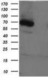 Anti-XPNPEP1 antibody [1E3] used in Western Blot (WB). GTX83414