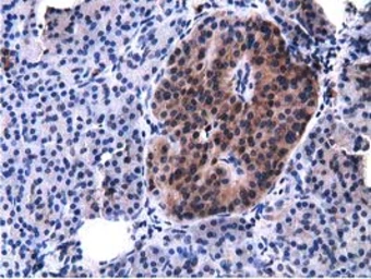 Anti-VWA5A antibody [3D6] used in IHC (Paraffin sections) (IHC-P). GTX83424