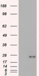 Anti-VEGFA antibody [4G3] used in Western Blot (WB). GTX83425