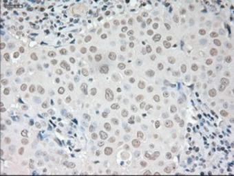 Anti-VEGFA antibody [4E3] used in IHC (Paraffin sections) (IHC-P). GTX83426