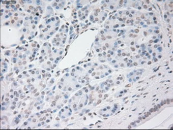 Anti-VEGFA antibody [4E3] used in IHC (Paraffin sections) (IHC-P). GTX83426