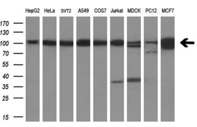 Anti-USP5 antibody [2F5] used in Western Blot (WB). GTX83431
