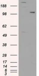 Anti-USP38 antibody [1D11] used in Western Blot (WB). GTX83434